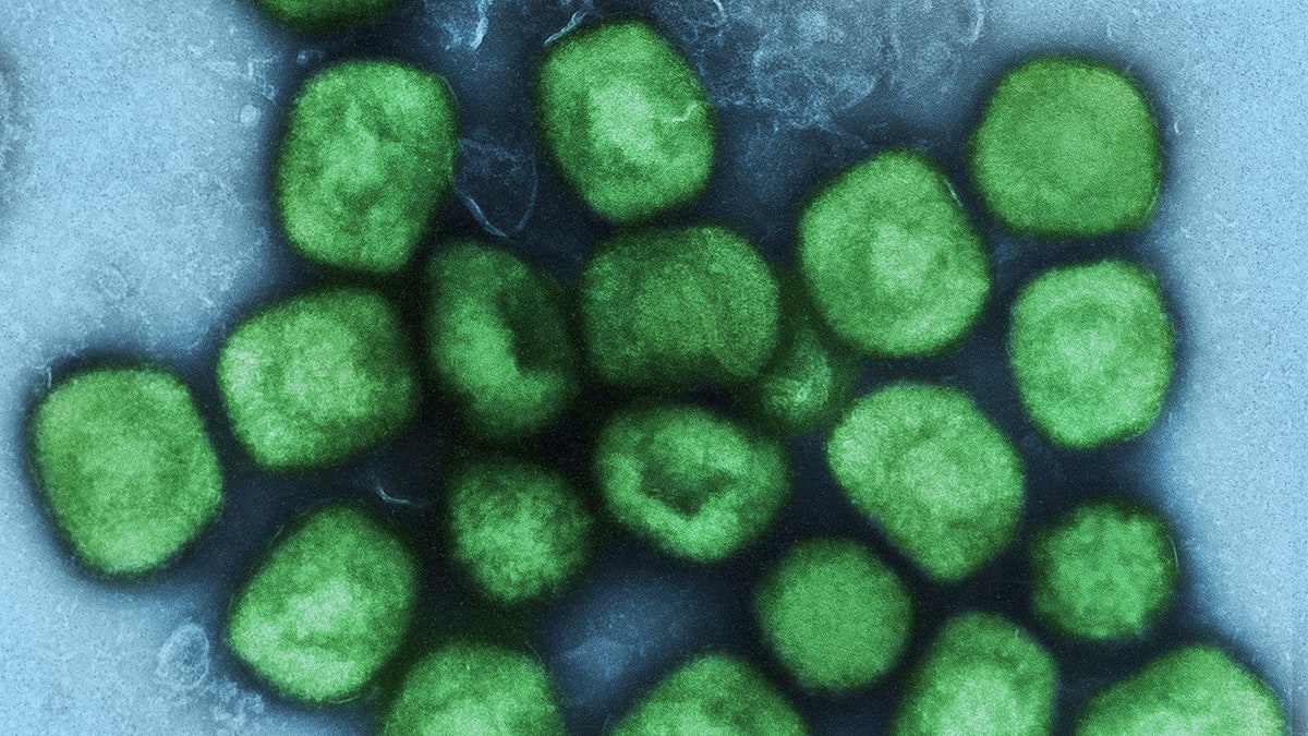 Colourised electron microscope image of monkeypox virus particles, shown in green